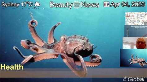 ms london bbc|Major moment in MS research as new Octopus trial starts